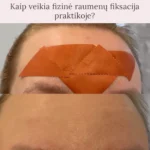 Pleistrai nuo raukšlių - Image 4
