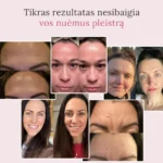 Pleistrai nuo raukšlių - Image 5